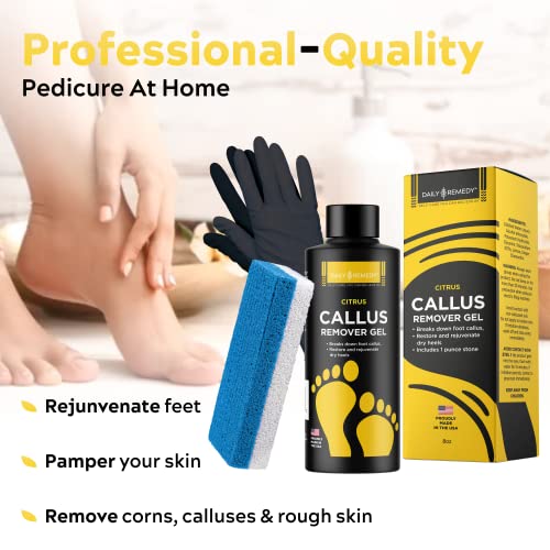 Daily Remedy Citrus Callus Remover Gel & Pumice Stone Set for Feet - Extra St...