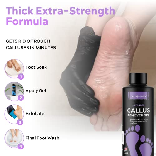 Daily Remedy Lavender Callus Remover Gel & Pumice Stone Set for Feet - Extra ...