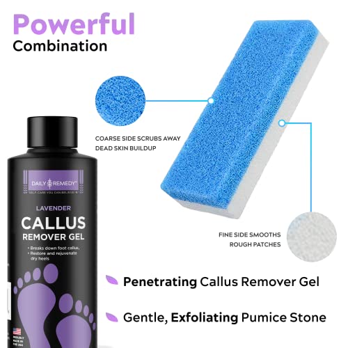 Daily Remedy Lavender Callus Remover Gel & Pumice Stone Set for Feet - Extra ...