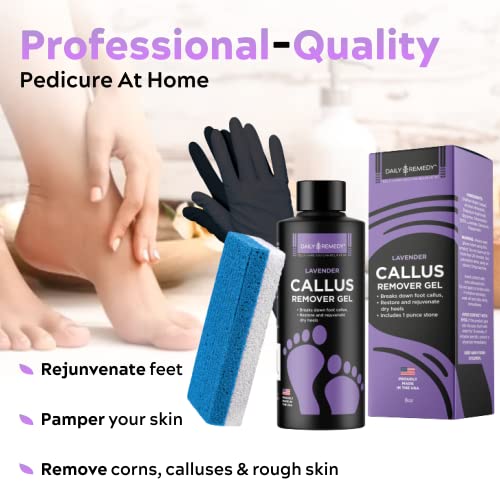 Daily Remedy Lavender Callus Remover Gel & Pumice Stone Set for Feet - Extra ...