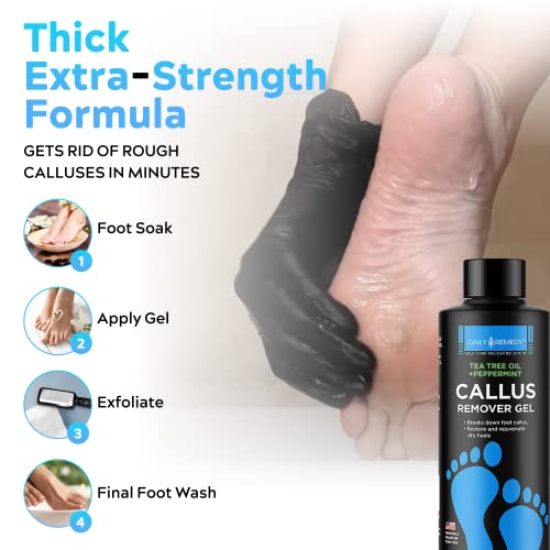 Daily Remedy Tea Tree Oil Foot Soak, Callus Remover Gel & Foot File- Complete...