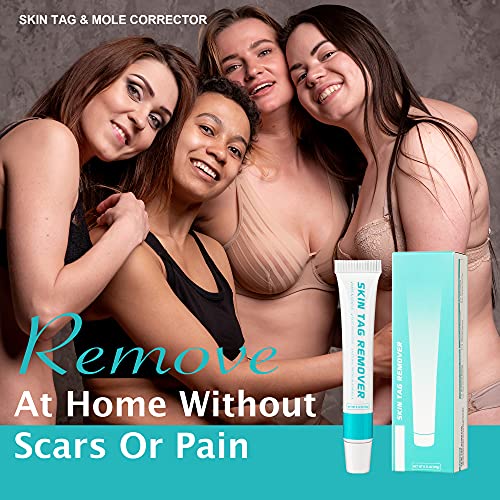 Skin Tag Remover Cream, Wart & Mole Remover - Quickly and Easily Remove Commo...