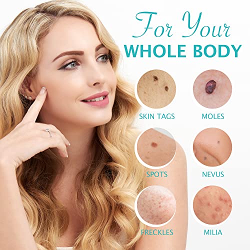 Skin Tag Remover Cream, Wart & Mole Remover - Quickly and Easily Remove Commo...