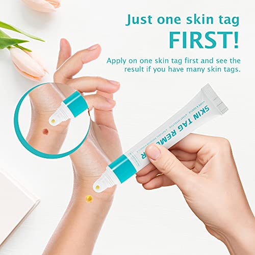 Skin Tag Remover Cream, Wart & Mole Remover - Quickly and Easily Remove Commo...