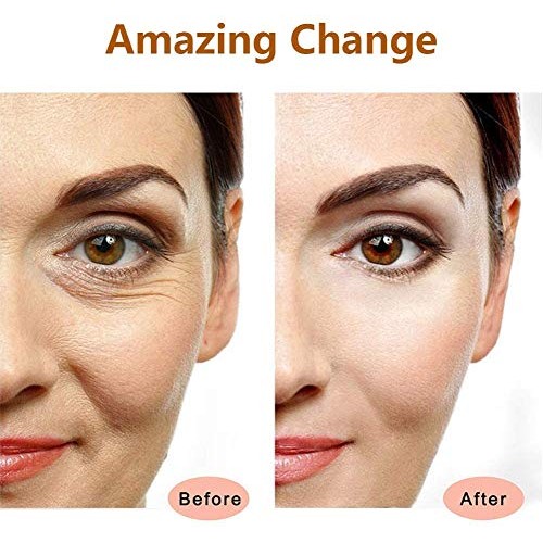 2-IN-1 Electric Face Massager 24k Golden Facial Massager, 3D Roller and T Sha...