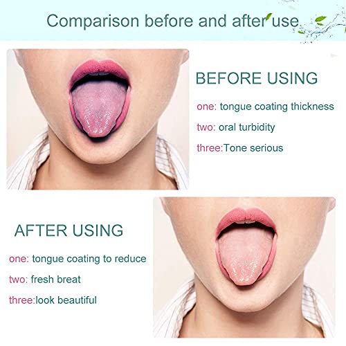 Tongue Scraper for Adults,Tongue Cleaner,Tounge Scraper Cleaner,Tongue Brush,...