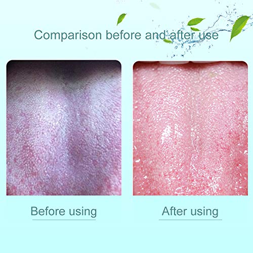 Tongue Scraper for Adults,Tongue Cleaner,Tounge Scraper Cleaner,Tongue Brush,...