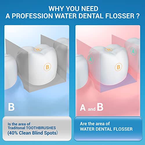 Professional Cordless Water Dental Flosser - DayAndNai Portable Waterproof Te...