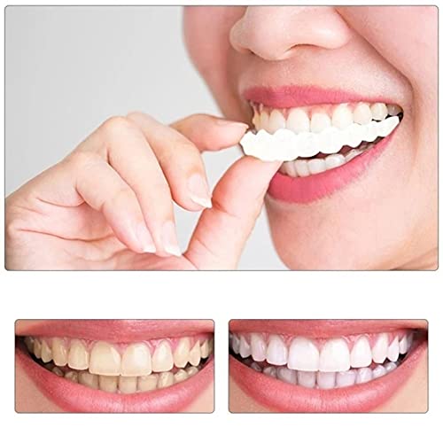 DBSUN Snap on Smile Braces, Smile Big with Confidence Instantly,One Size Fit ...