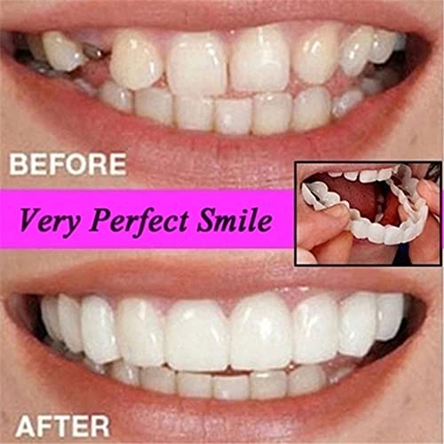DBSUN Snap on Smile Braces, Smile Big with Confidence Instantly,One Size Fit ...