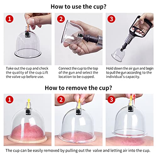 Cupping Therapy Set,32 Therapy Cups Cupping Set with Pump, Professional Chine...