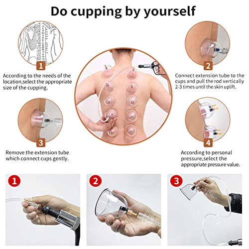 Cupping Therapy Set,32 Therapy Cups Cupping Set with Pump, Professional Chine...