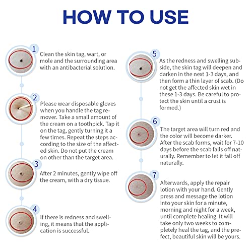 Skin Tag Remover, Mole Remover and Repair Gel Set, Skin Tag Removal Treatment...