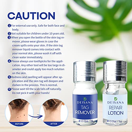 Skin Tag Remover, Mole Remover and Repair Gel Set, Skin Tag Removal Treatment...