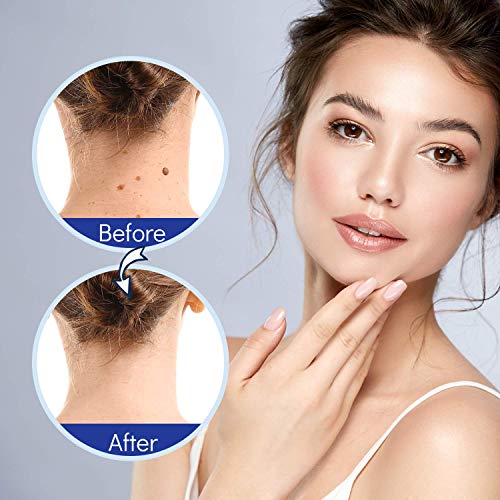 Skin Tag Remover, Mole Remover and Repair Gel Set, Skin Tag Removal Treatment...