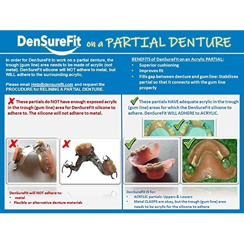 DenSureFit Lower Denture Reline Kit