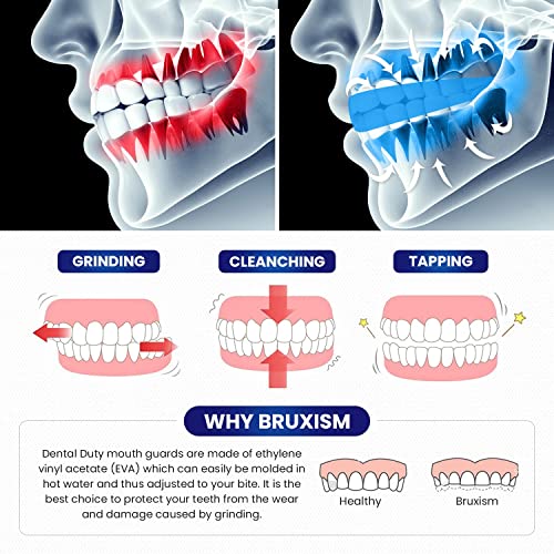 Professional Mouth Guard for Grinding Teeth, 2 Sizes, 4 Pieces Mouthguard, Mo...