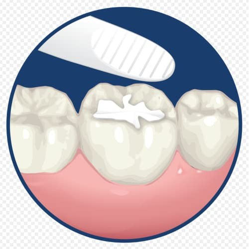 Dentemp Maximum Strength Loose Cap and Lost Filling Repair - Dental Repair Ki...