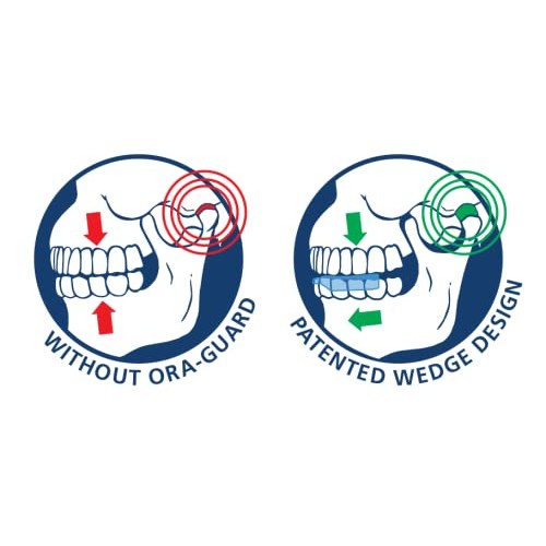 Dentemp Ora-GUARD Custom Fit Dental Guard - Bruxism Night Guard for Teeth Gri...