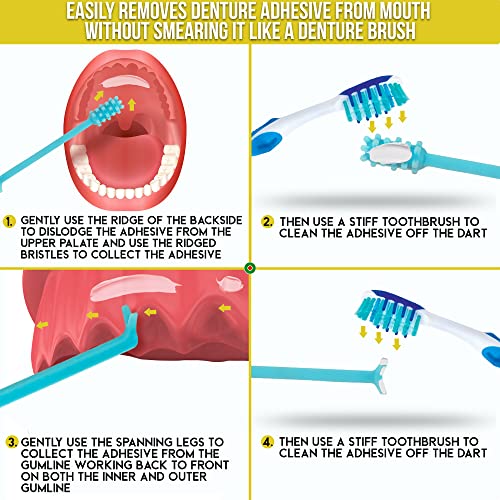 Denture Dart V2 Denture Gel Adhesive Remover - Remove Denture Gel Adhesive fr...