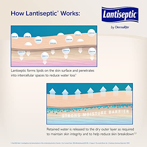 Lantiseptic Moisture Shield Original Skin Protectant – 50% Lanolin Enriched S...