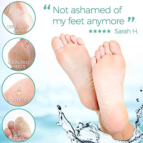 Foot Peel Mask - Rose - For Cracked Heels, Dead Skin and Calluses - Make Your...