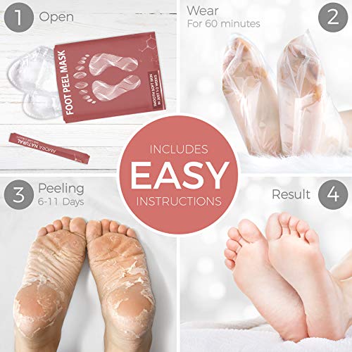 Foot Peel Mask - Rose - For Cracked Heels, Dead Skin and Calluses - Make Your...