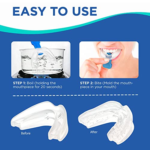Difiney Mouth Guard, Snoring Solution, Professional Dental Guard, Pack of 1, ...