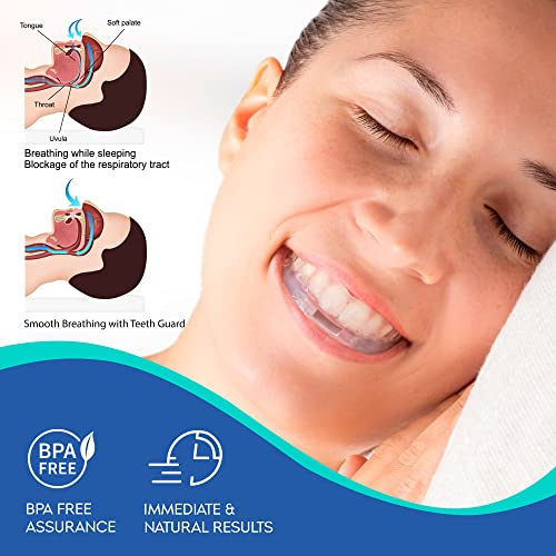 Difiney Mouth Guard, Snoring Solution, Professional Dental Guard, Pack of 1, ...