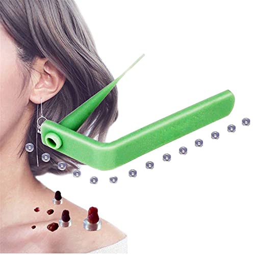 DINHAND Skin Tag Remover, Micro Skin Tag Removal Kit for Small to Medium (2mm...