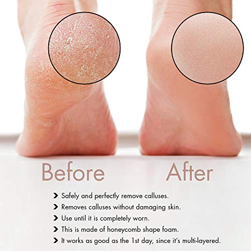 Professional Pedicure Foot File, Foot File Rasp, Callus Remover, Foot Scrubbe...