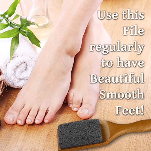 Professional Pedicure Foot File, Foot File Rasp, Callus Remover, Foot Scrubbe...