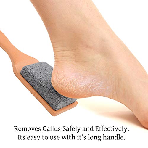 Professional Pedicure Foot File, Foot File Rasp, Callus Remover, Foot Scrubbe...