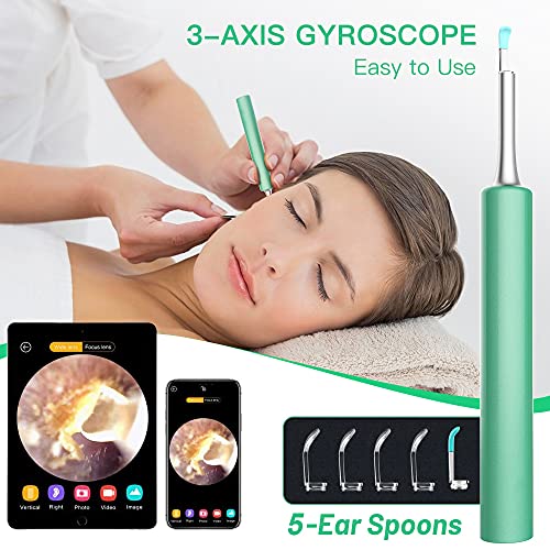DJROLL Ear Wax Removal, Earwax Remover Tool, Ear Camera, Ear Scope with Ear W...
