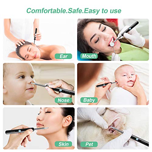 Earwax Removal Tool with Camera,Earwax Cleaner Tools with 1080P FHD Wireless ...