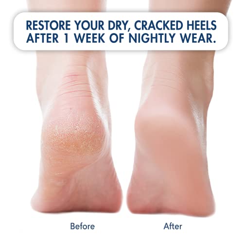 Dr. Frederick's Original Moisturizing Heel Socks for Cracked Heel Treatment -...