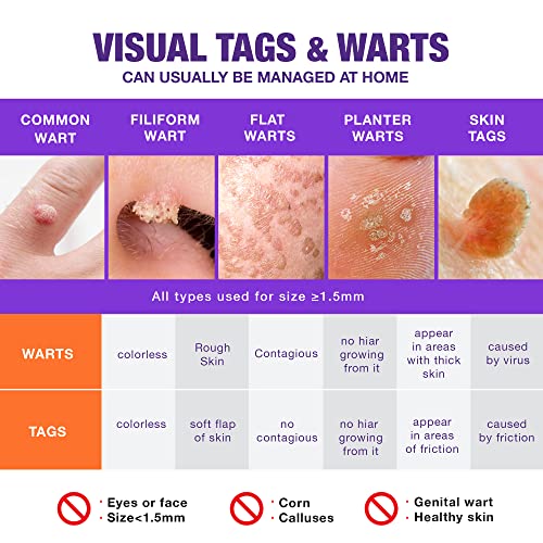 2×Extra Strength Skin Tag Remover Mask, Skin Tag Removal Mask, Exclusive Form...