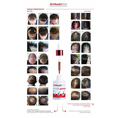 Dr. Meral's Elixir - Essential Hair Growth Products Kit: Minoxidil Free Thinn...