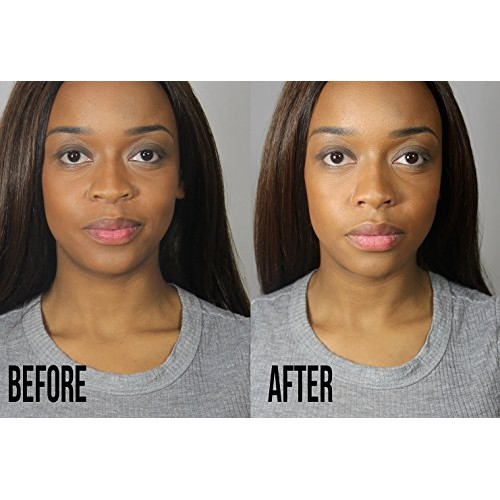 Dr Rogo Natural Nose Clip to Avoid Plastic Surgery for Nose up Lifting Shapin...