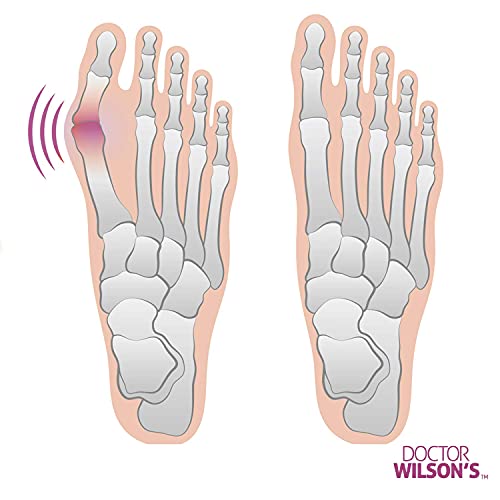 Bunion Corrector - Bunion Relief Pads Sleeve - Bunion Splint Orthopedic Bunio...