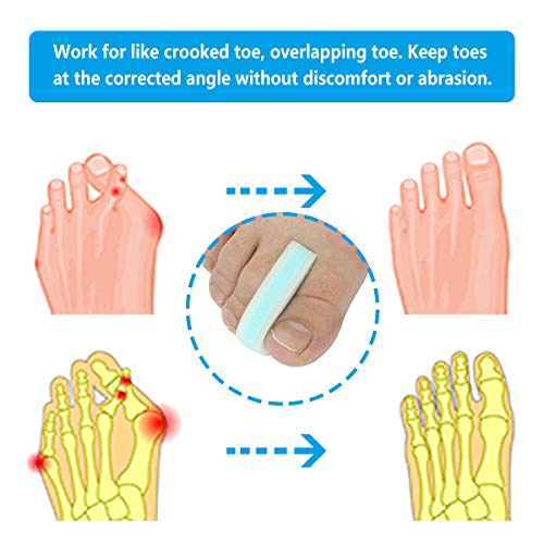 ORANDESIGNE Foam Toe Separators 3-Layer Foam Toe Spacer for Bunion Pain Relie...