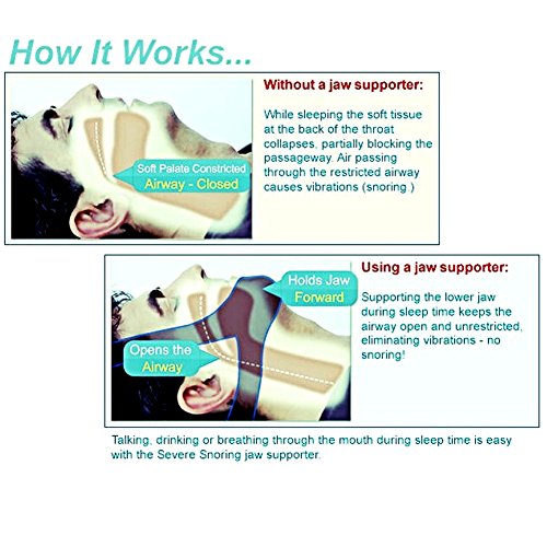 1PC Chin Strap - New Device - Sleep Support Belt, Sleep Aids Belt, Suitable F...