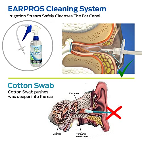 EARPROS Ear Wax Removal Tool Kit Ear Cleaning System Ear Irrigation Kit - Ear...