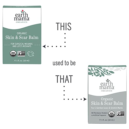 Organic Skin & Scar Balm by Earth Mama | Reduces the Discomfort and Appearanc...