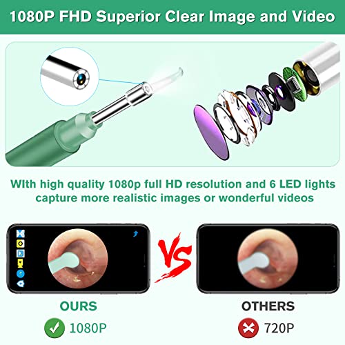 Ear Wax Removal,Earwax Remover Camera with 1080P,Ear Cleaner with Camera,Wire...