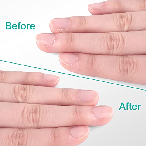 Cuticle Trimmer with Cuticle Pusher, Easkep Cuticle Remover Cuticle Nipper Pr...