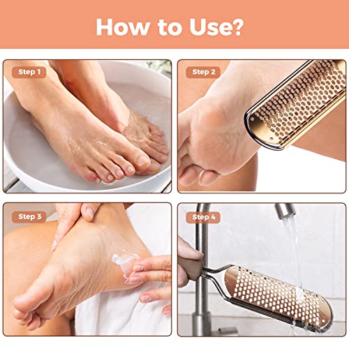 Foot File Foot Scrubber Pedicure - Callus Remover for Feet Easkep Professiona...