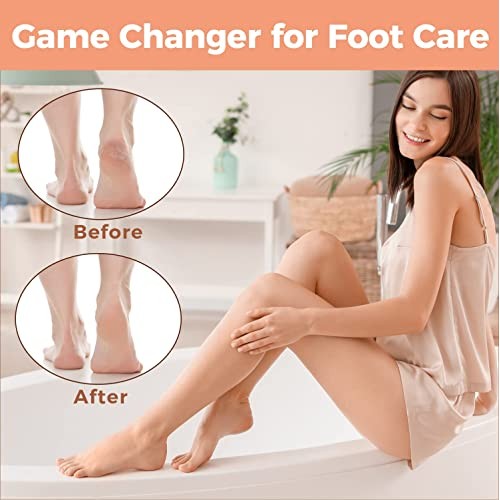 Foot File Foot Scrubber Pedicure - Callus Remover for Feet Easkep Professiona...