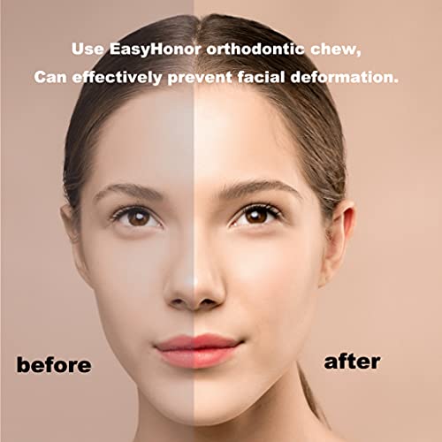 [Lengthened Version] EasyHonor Colourful Orthodontic Aligner Trays Chewies fo...