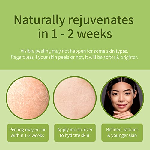 Ebanel 30% AHA 2% BHA Chemical Peel Exfoliant Gel, Face Peel with Glycolic Ac...